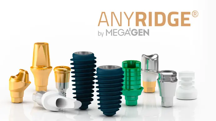 Импланты AnyRidge (ЭниРидж)