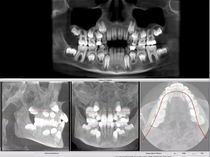 Компьютерная томография зубов в Одинцово в Одинцово