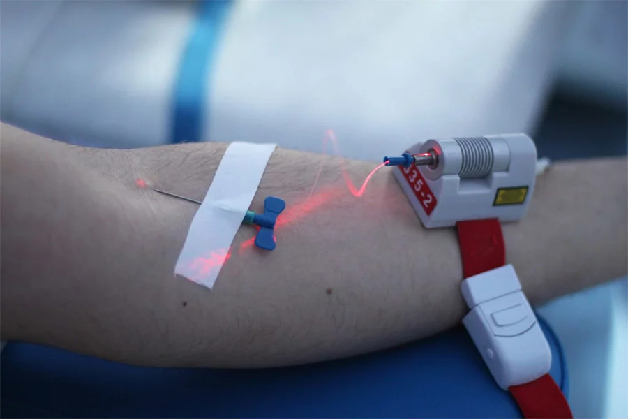 Внутривенное лазерное облучение крови в Одинцово (ВЛОК)