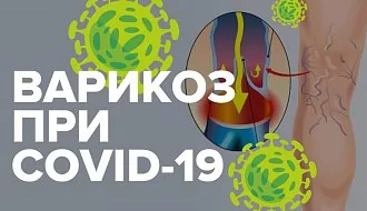 COVID-19 и варикозная болезнь