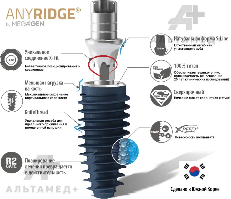 Конструкция импланта AnyRidge