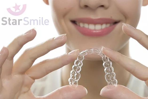 Элайнеры Star Smile: эстетичное решение неправильного прикуса